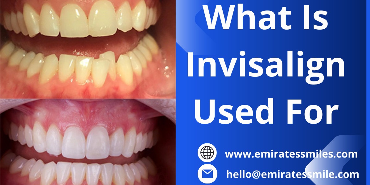 What Is Invisalign Used For